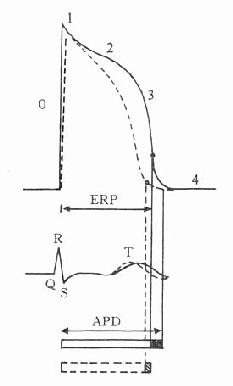 ERP和APD_ERP和APD_ERP和APD